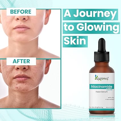 10% Niacinamide Face Serum with Zinc & Rice Extract – Fades Acne Marks & Dark Spots (30ml)
